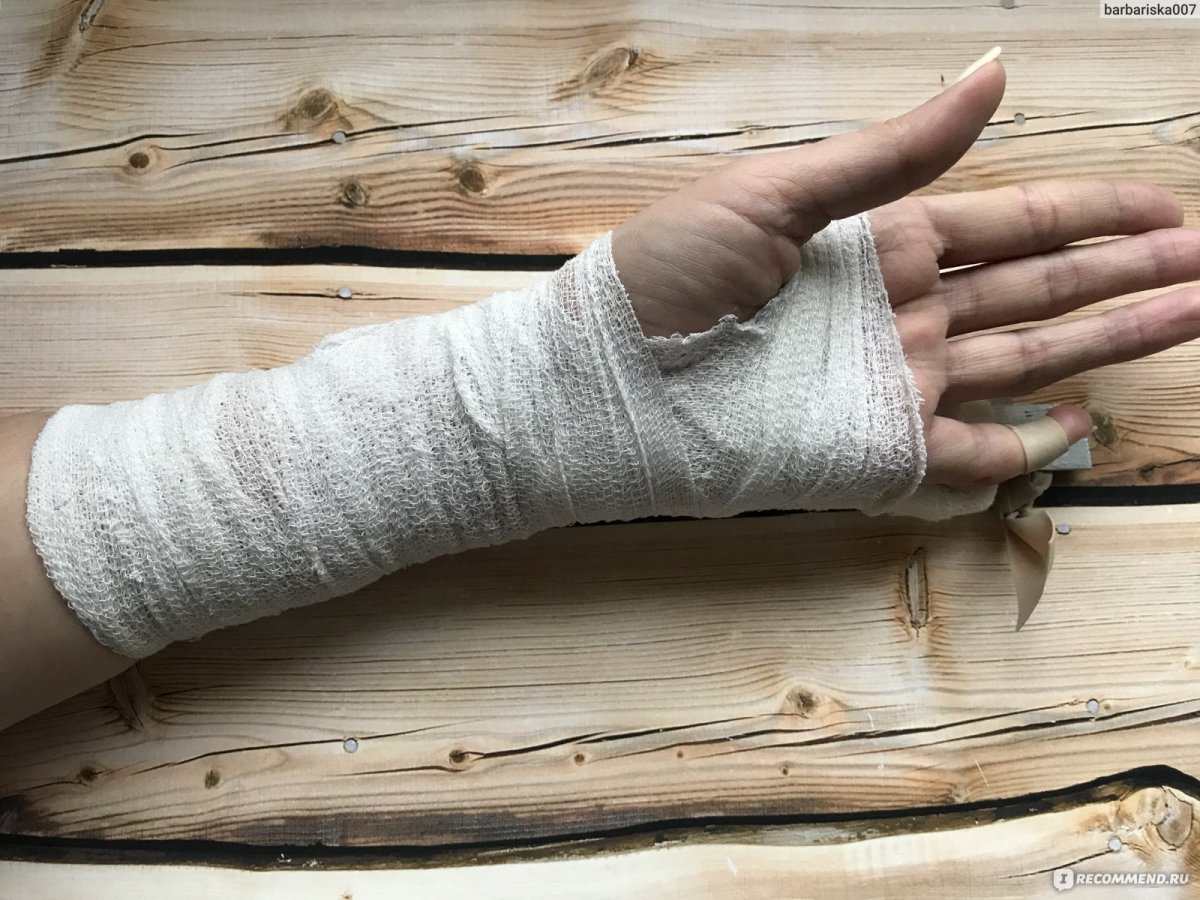 Перебентовананая рука