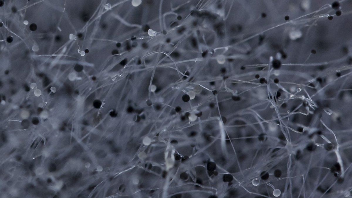 Черная плесень под микроскопом