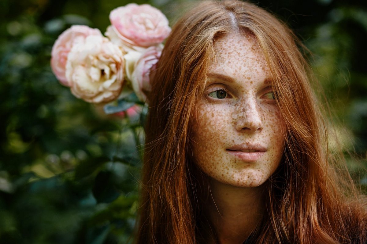 Кожа с веснушками