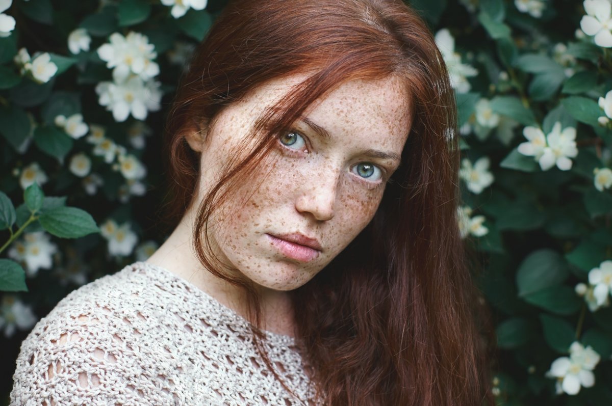Девушка с проблемной кожей