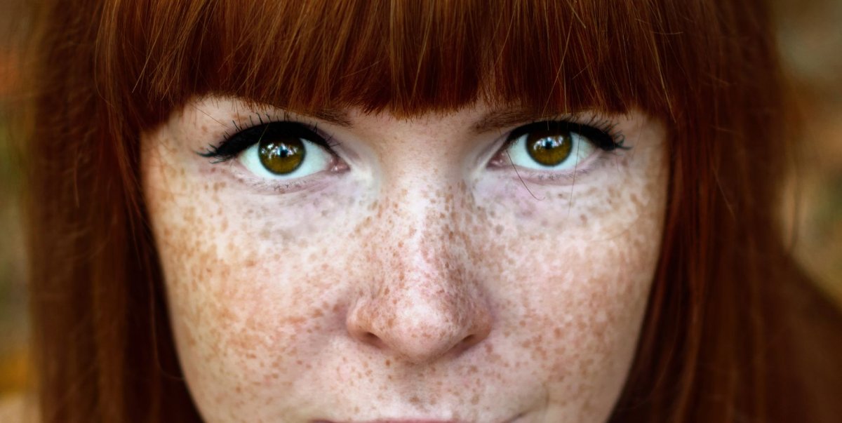 Эбигейл Коэн веснушки