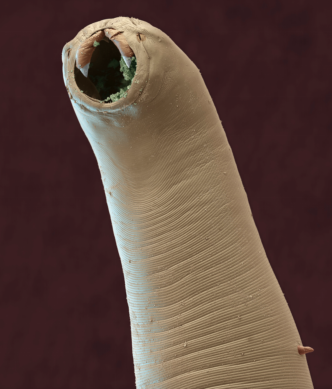 Фото под микроскопом под ногтями