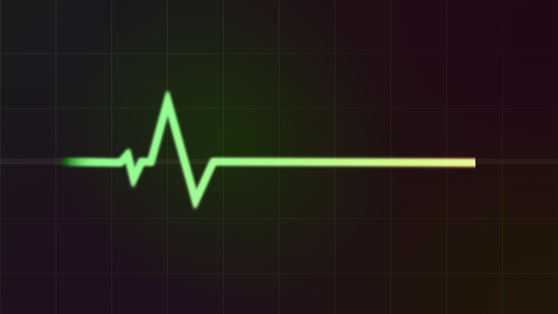 Остановка сердца на ЭКГ. Пульс. Диаграмма пульса. Кардилграммаостановка сердца. Сердцебиение остановилось