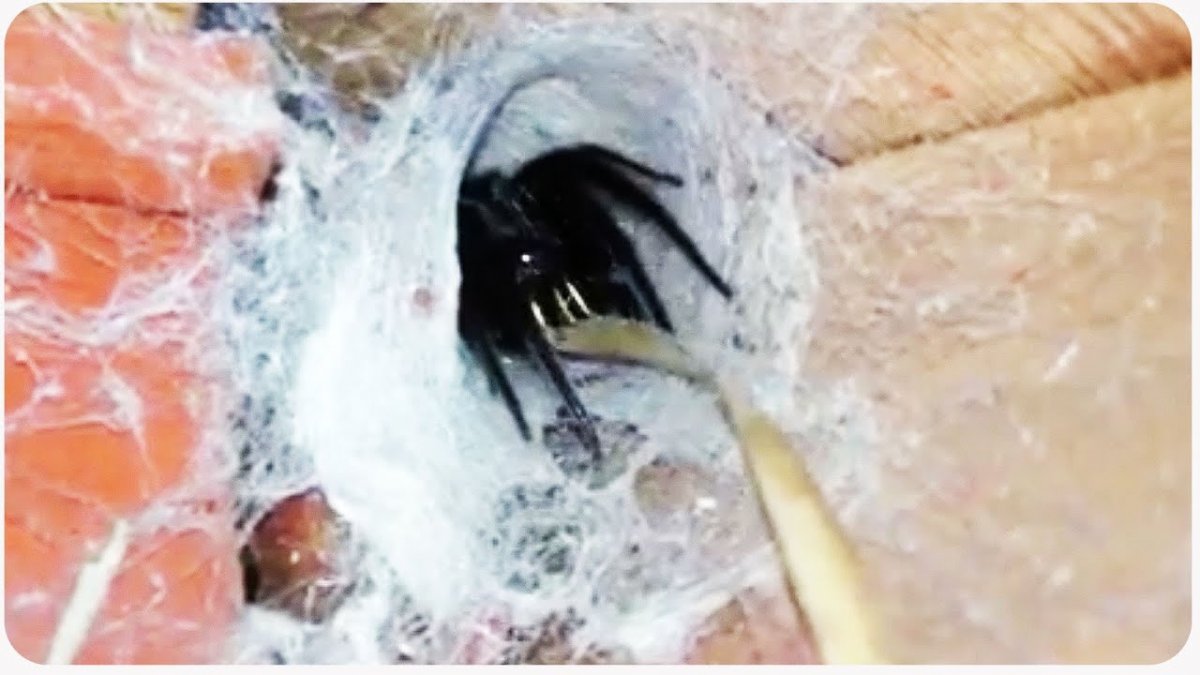 Stegodyphus dumicola