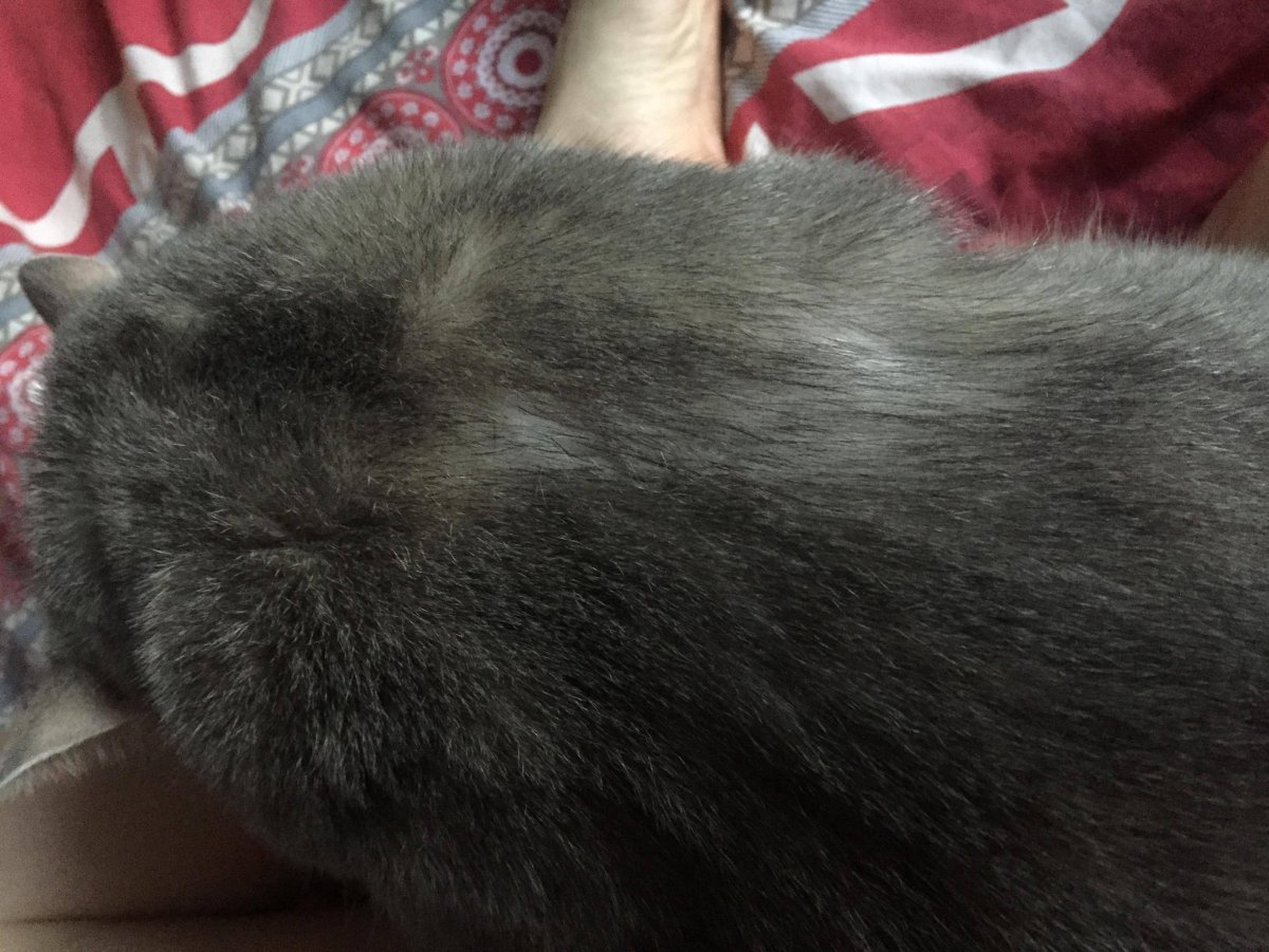 Гнездная алопеция распространенность