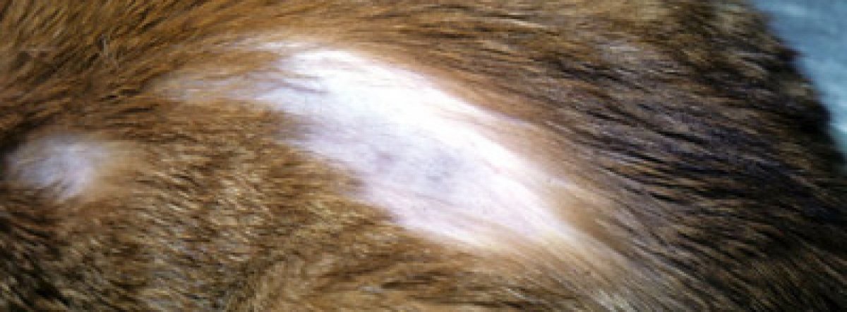 Очаговая (гнездная) алопеция