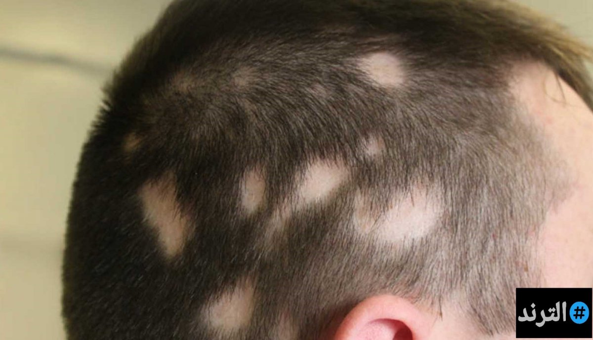 Болячки на залысинах у кота