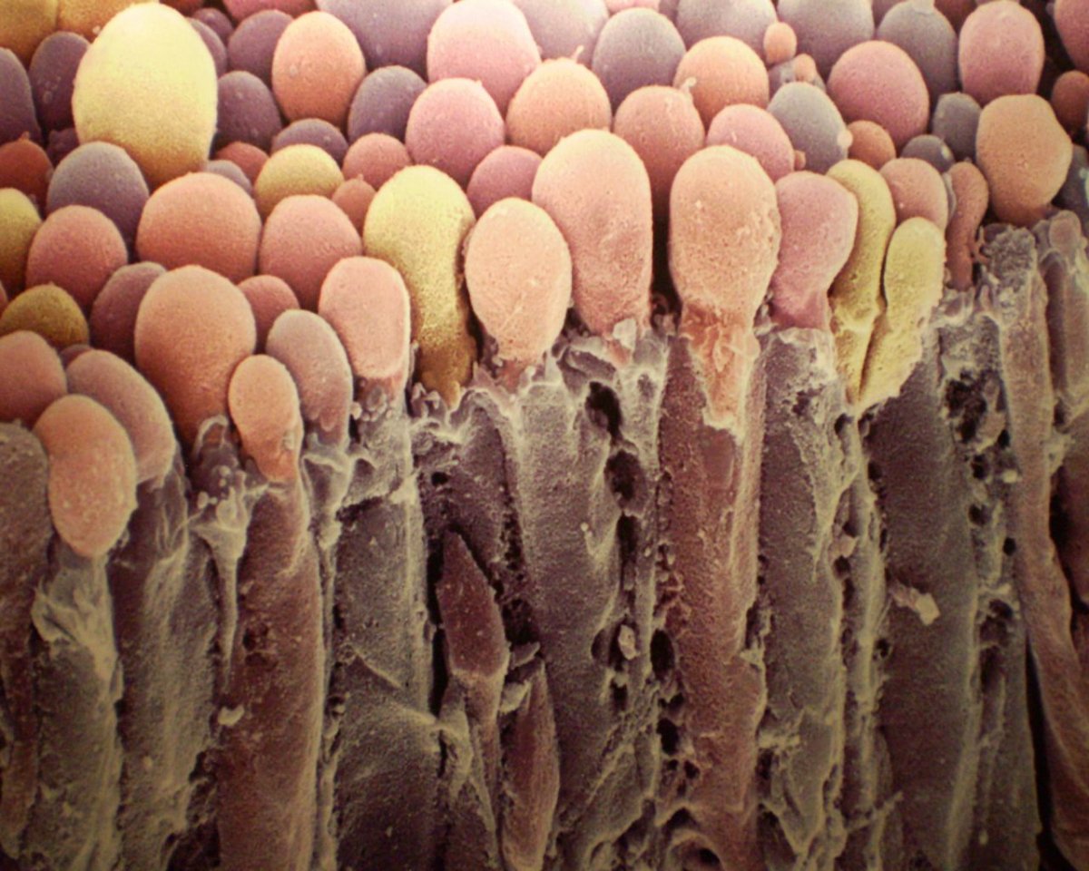 Археи под микроскопом