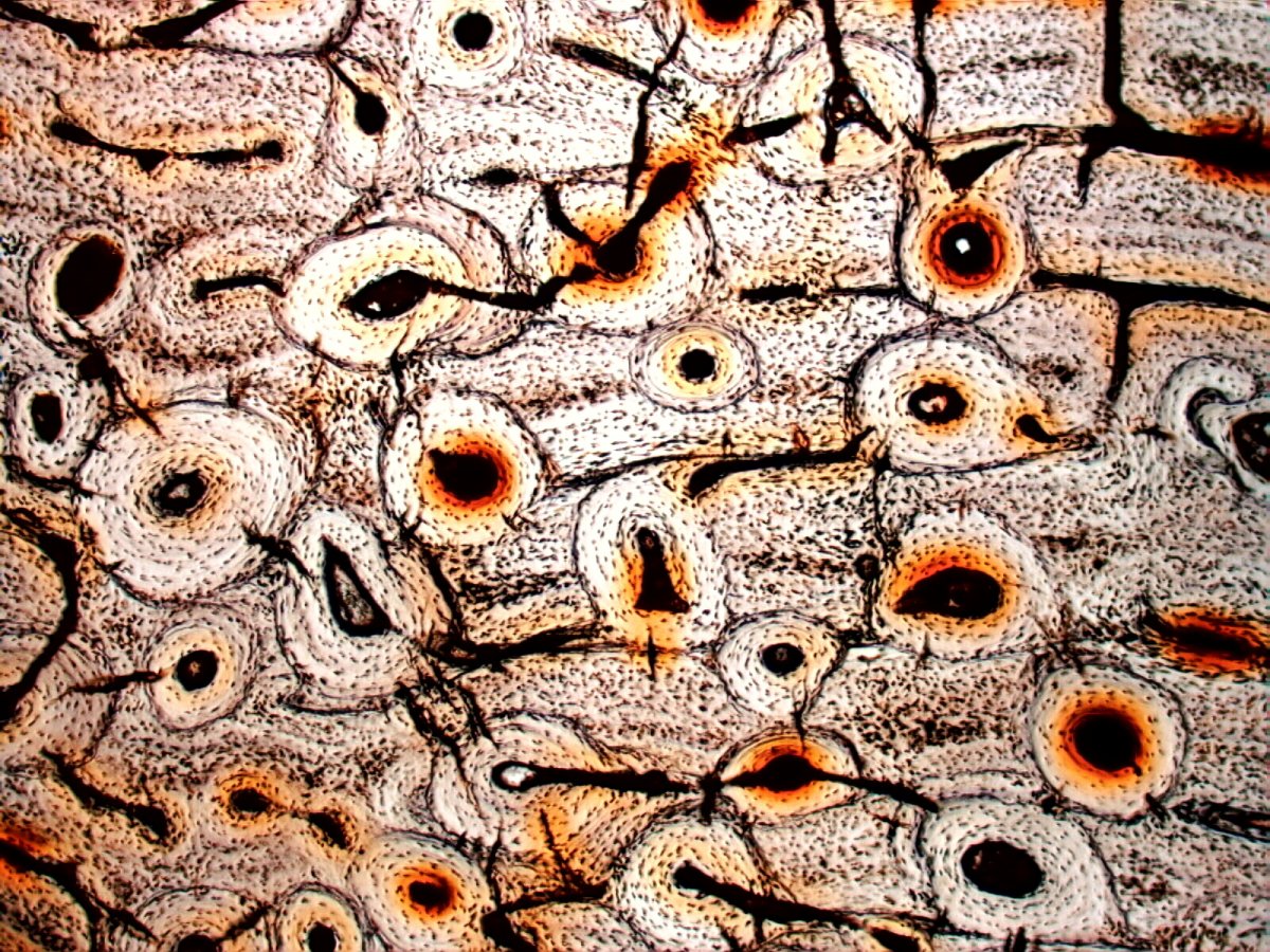 Костная ткань микрофотография