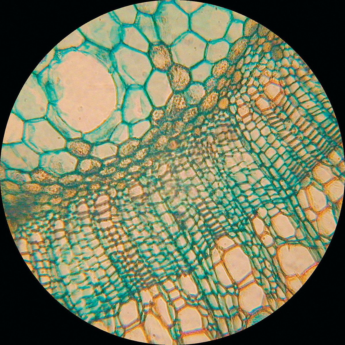 Бактериоид под микроскопом