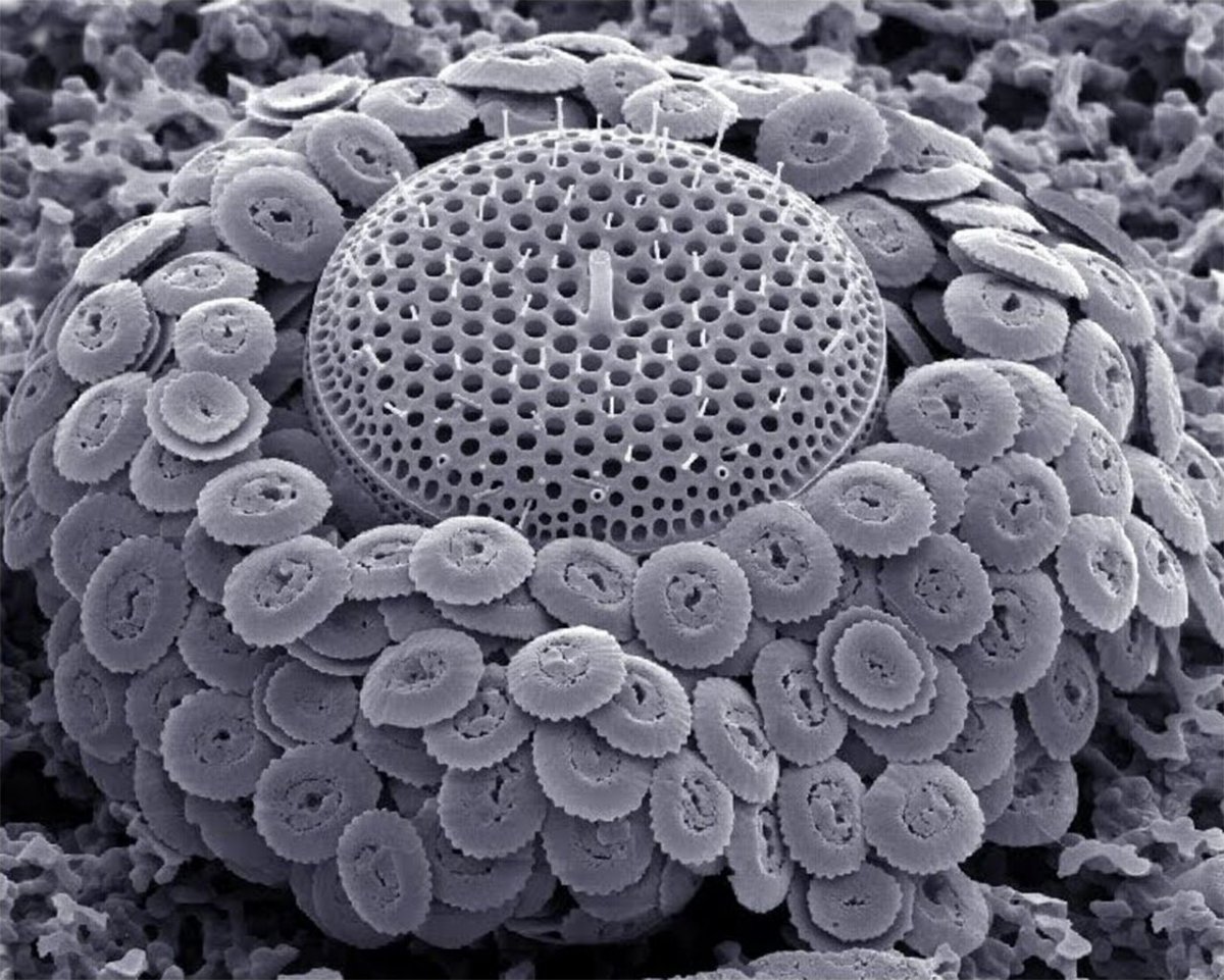 Микрофотография растительной клетки