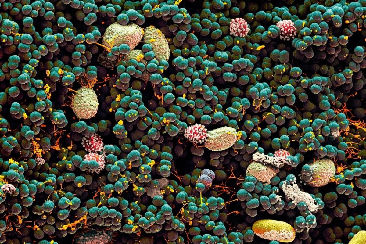 Микромир под электронным микроскопом