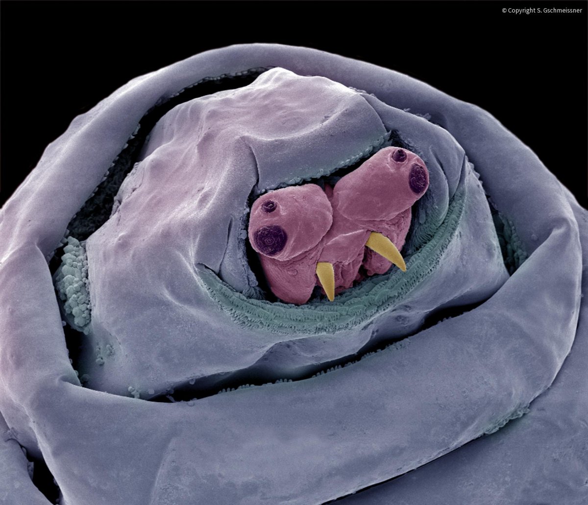 Земляной червь под микроскопом