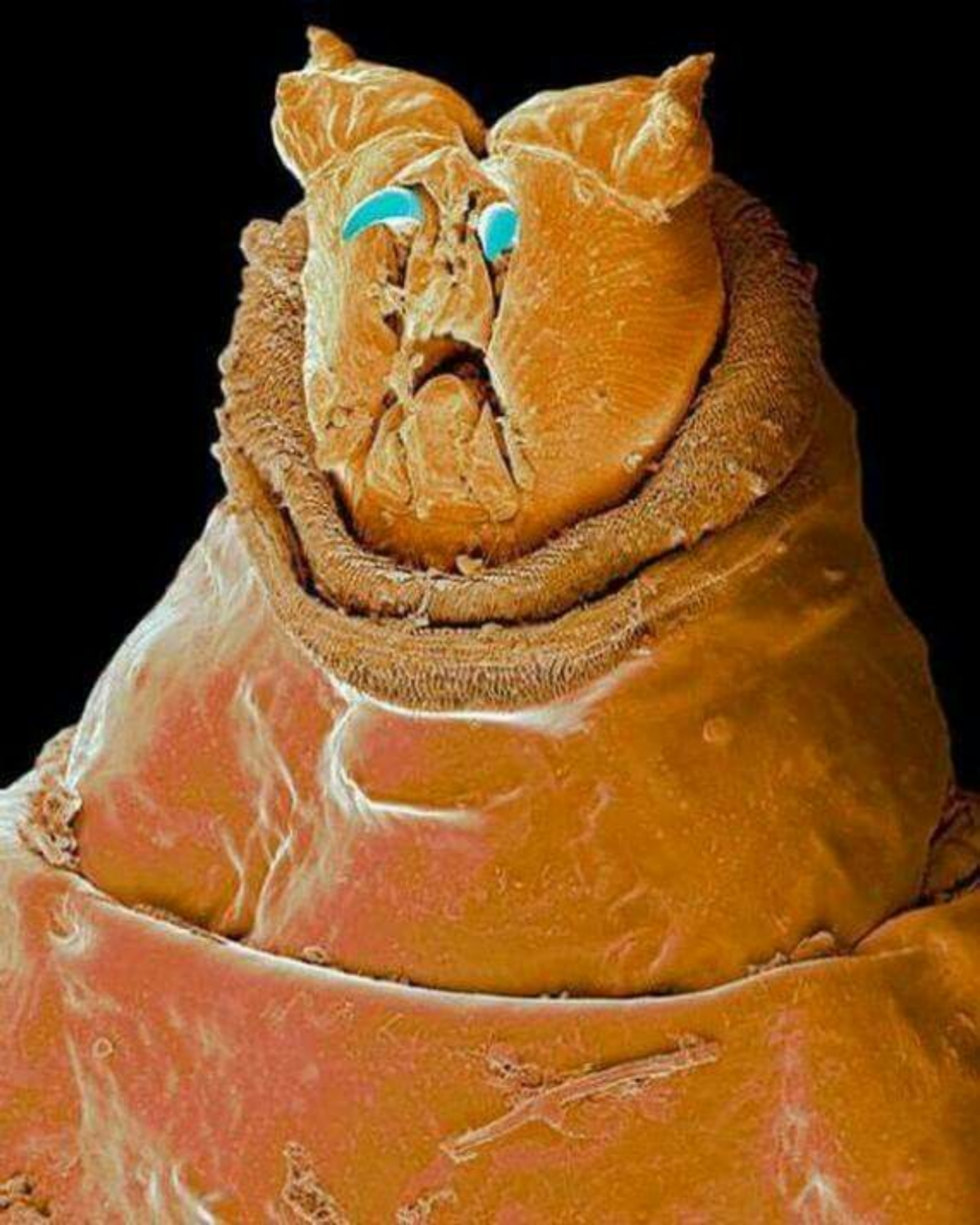 Червяк навозный под микроскоп