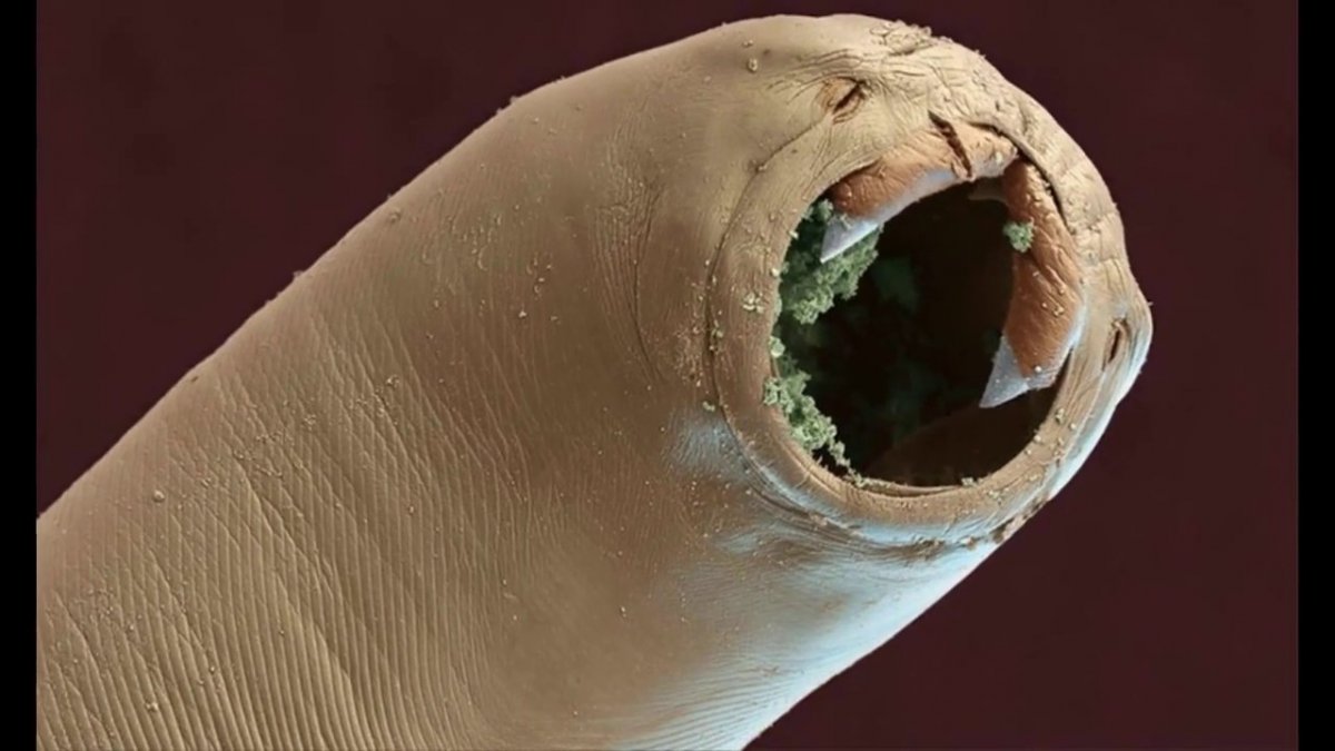 Щетинки гипантия