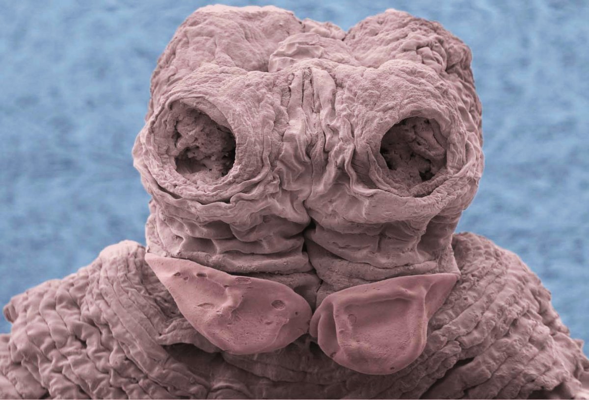 Микромир тихоходка