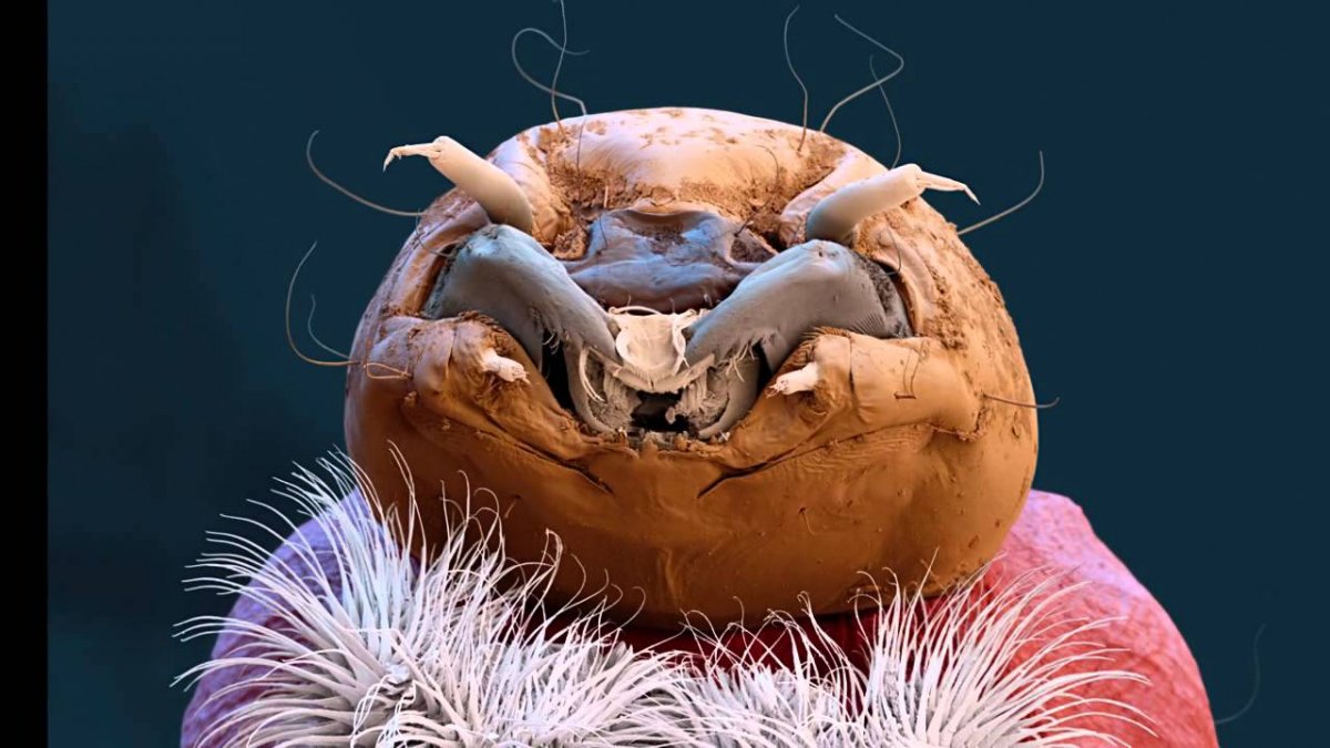 Обычный червь под микроскопом