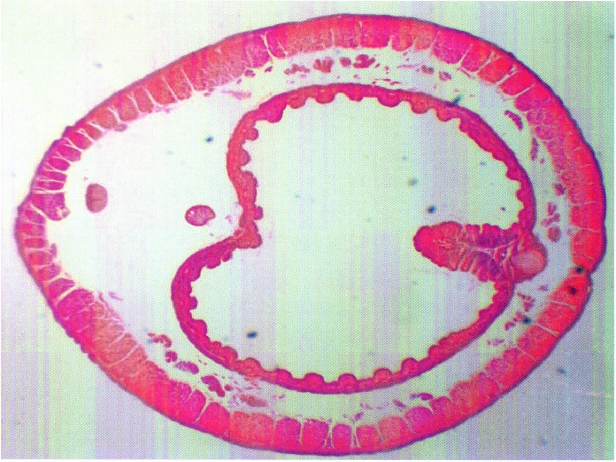 Дождевой червяк под микроскопом