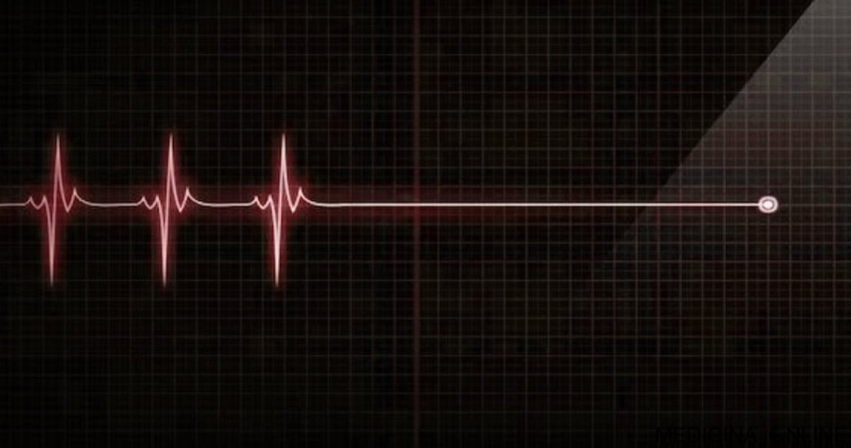 Обои на телефон пульс