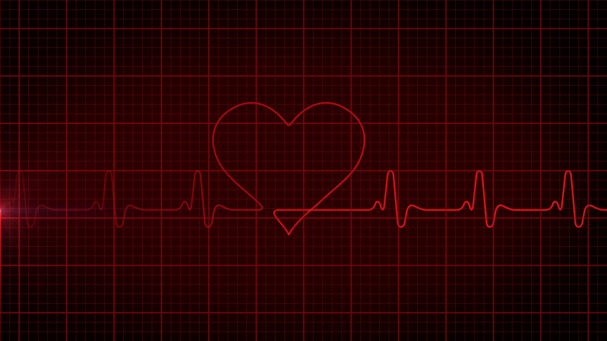 Кардиограмма остановки сердца