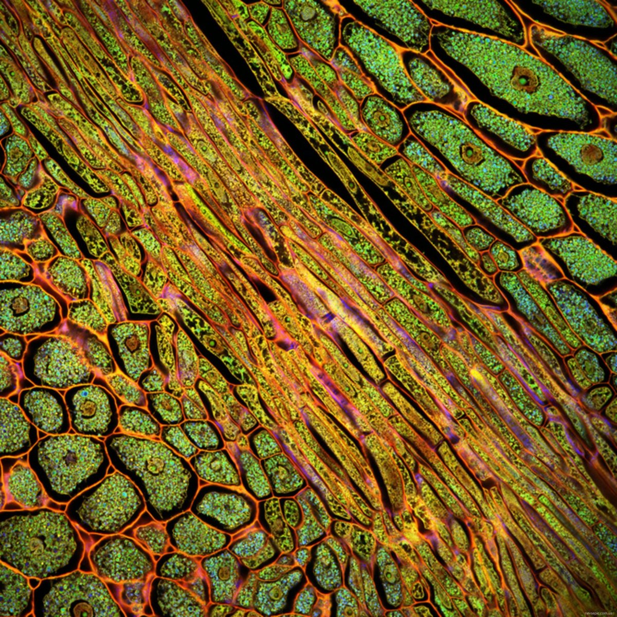 строение раст клетки под микроскопом фото 36