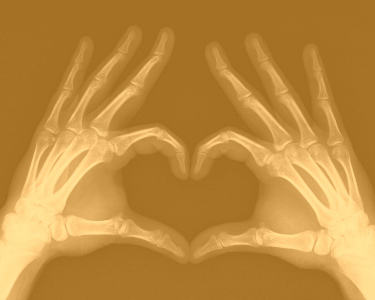 Сердце из рук скелета